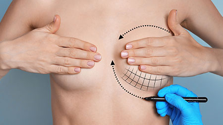 6 reasons why surgical bras are half of the success of beautiful breasts.  Read more! 