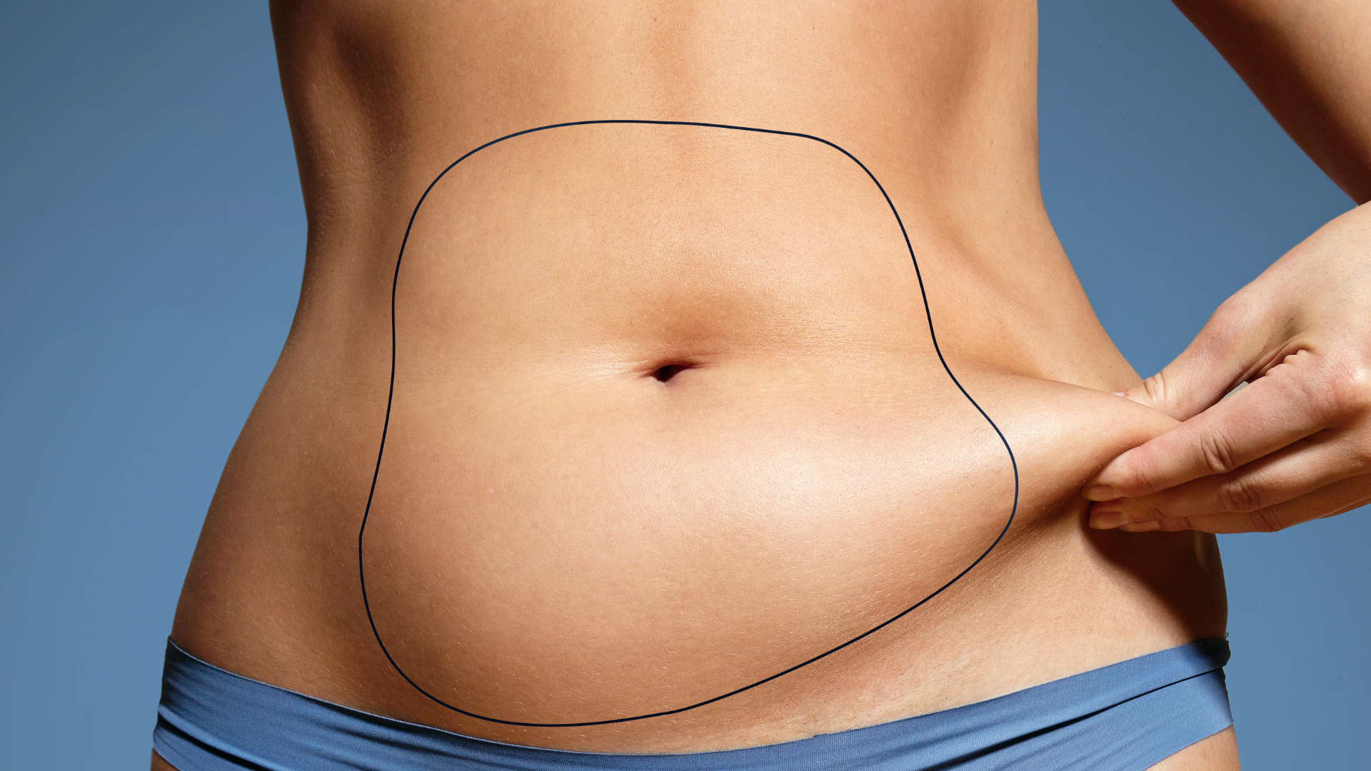 Liposuction vs Weight Loss Surgery: What Should You Choose?