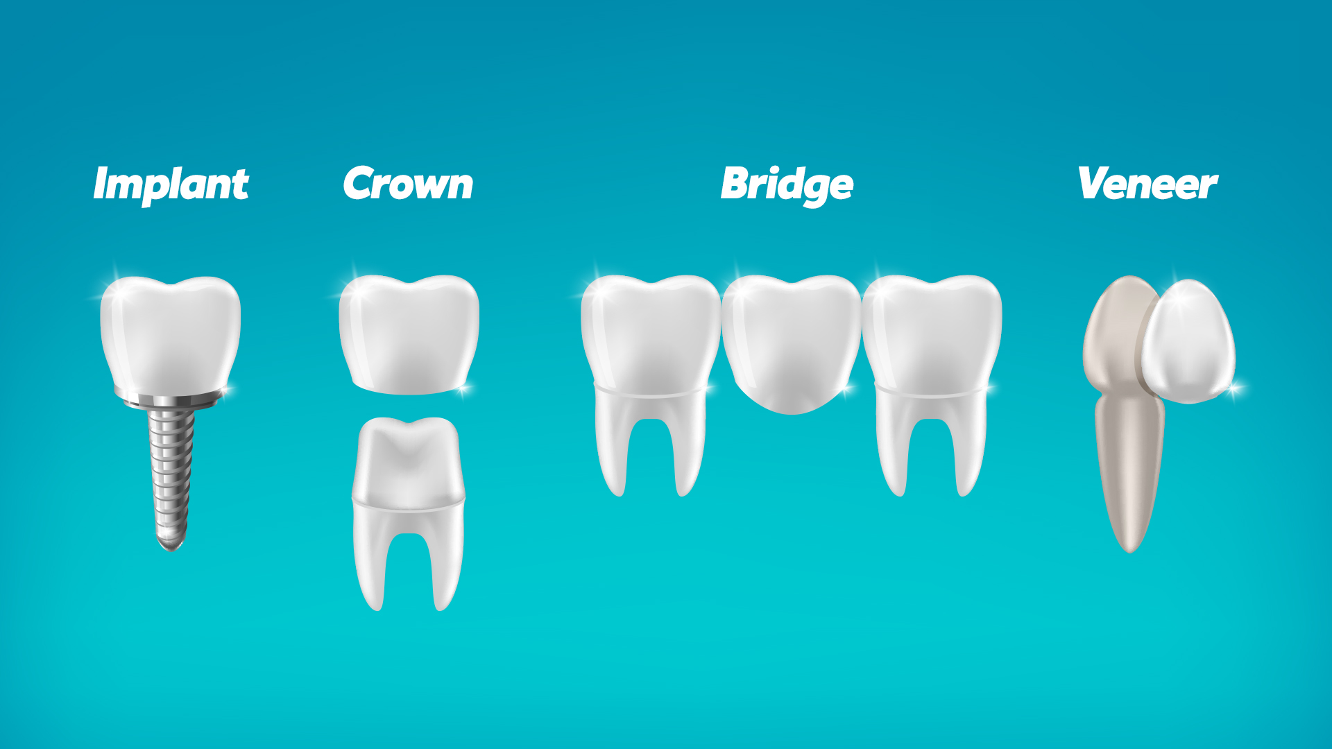 What is the Best Material for Fixed Dental Bridges? – Totally Dental